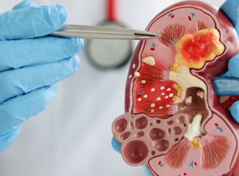 Nephrology