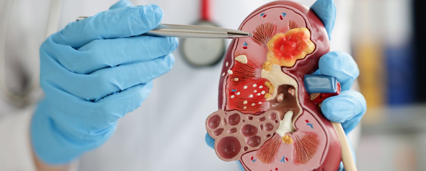 Nephrology